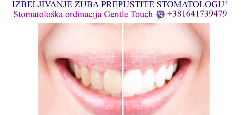 STOMATOLOŠKA-ORDINACIJA-GENTLE-TOUCH-DENTAL-CENTAR