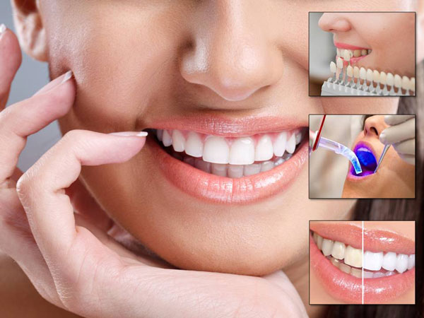 4663-cosmeticDentistry