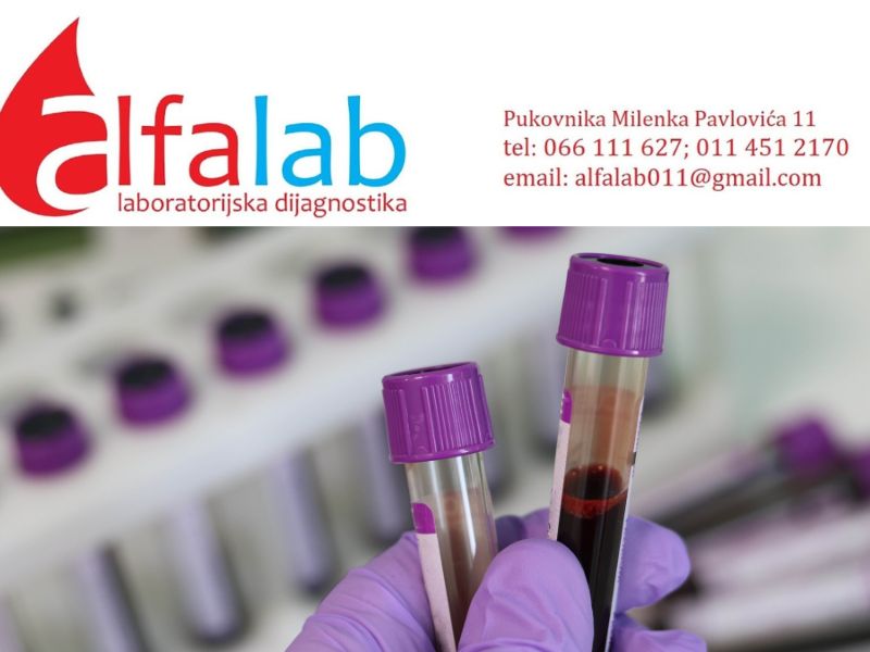 Biohemijska laboratorija Alfa Lab Batajnica 1 (2)