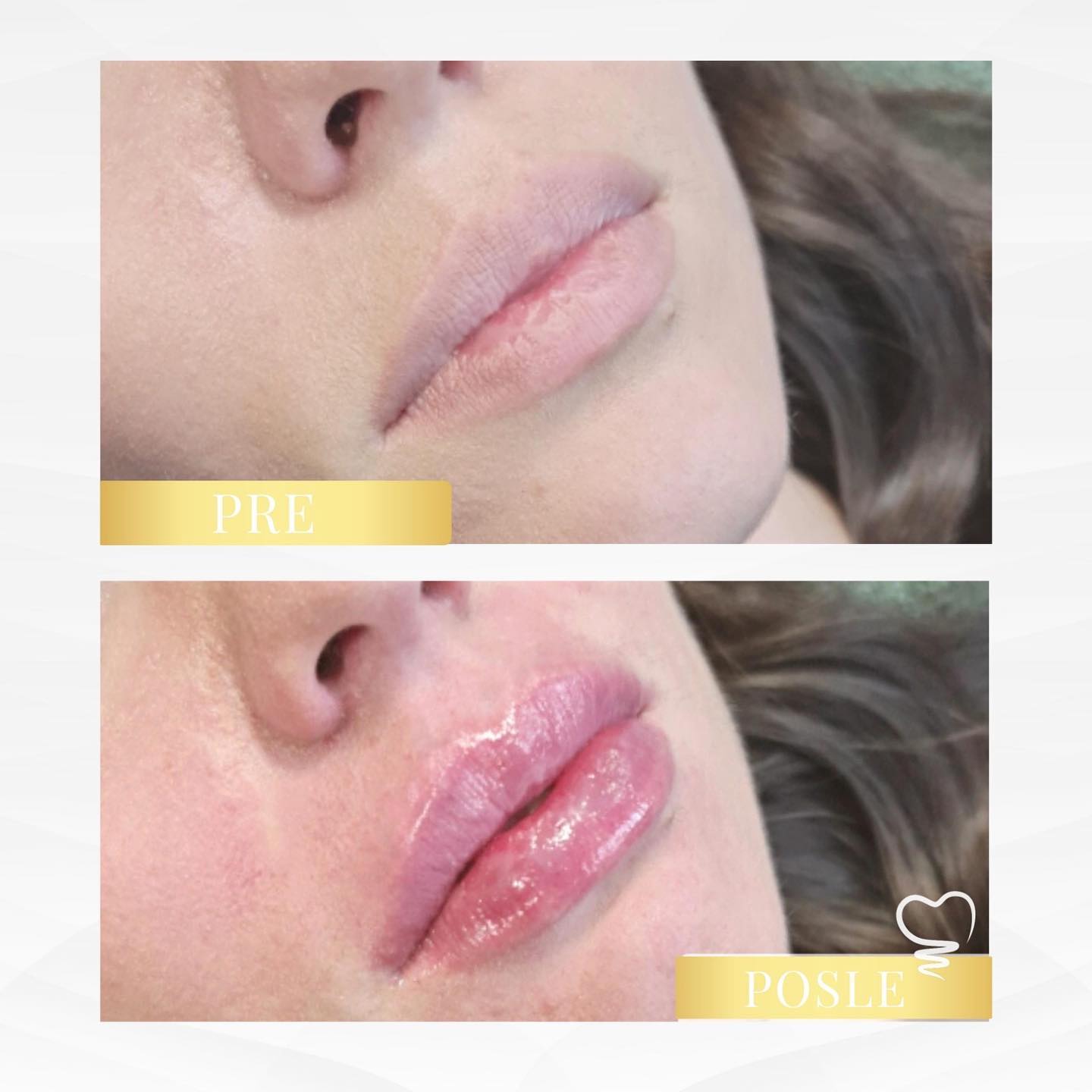 Dental & Aesthetic Center – Dr Miodrag Đokić Beograd (12)