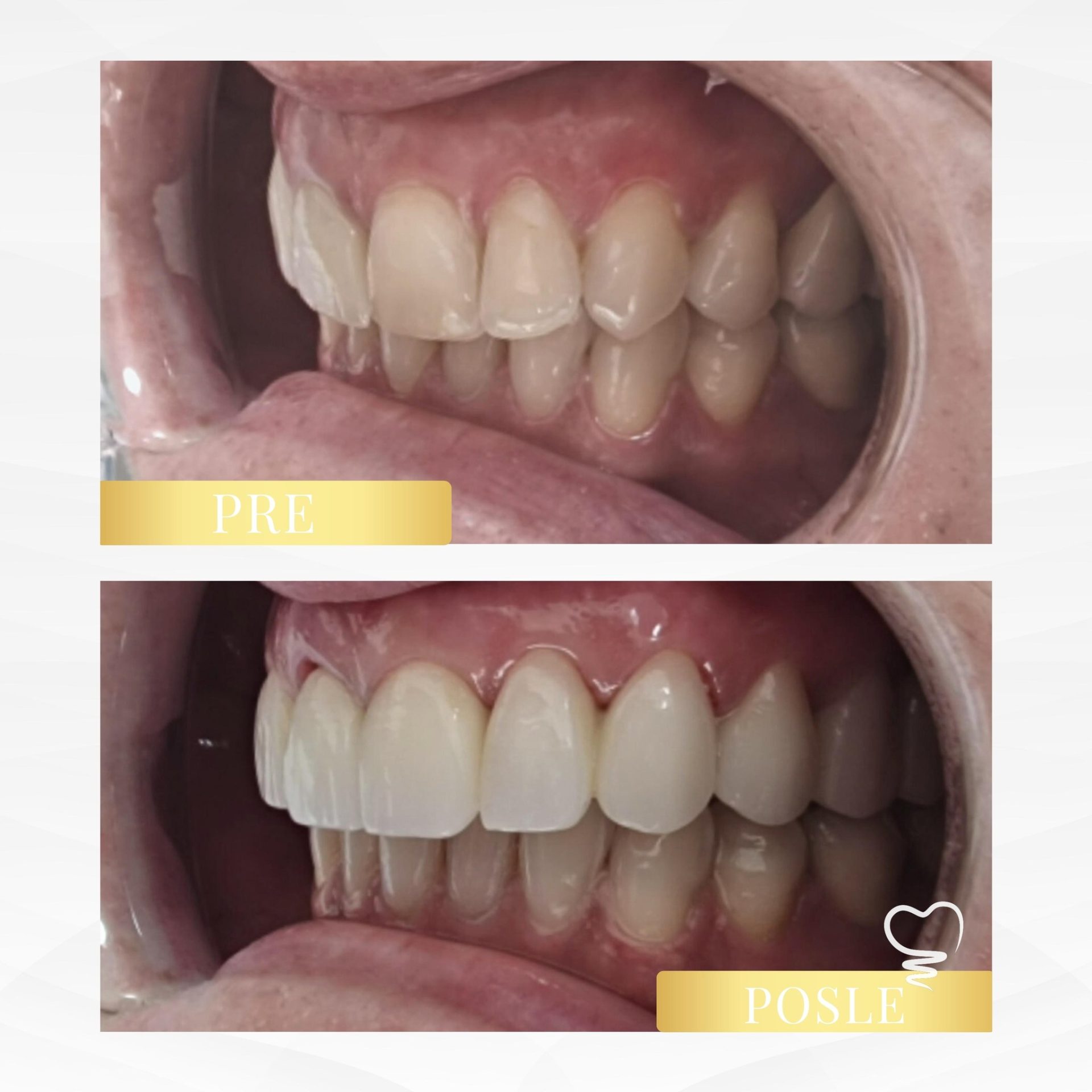 Dental & Aesthetic Center – Dr Miodrag Đokić Beograd (8)