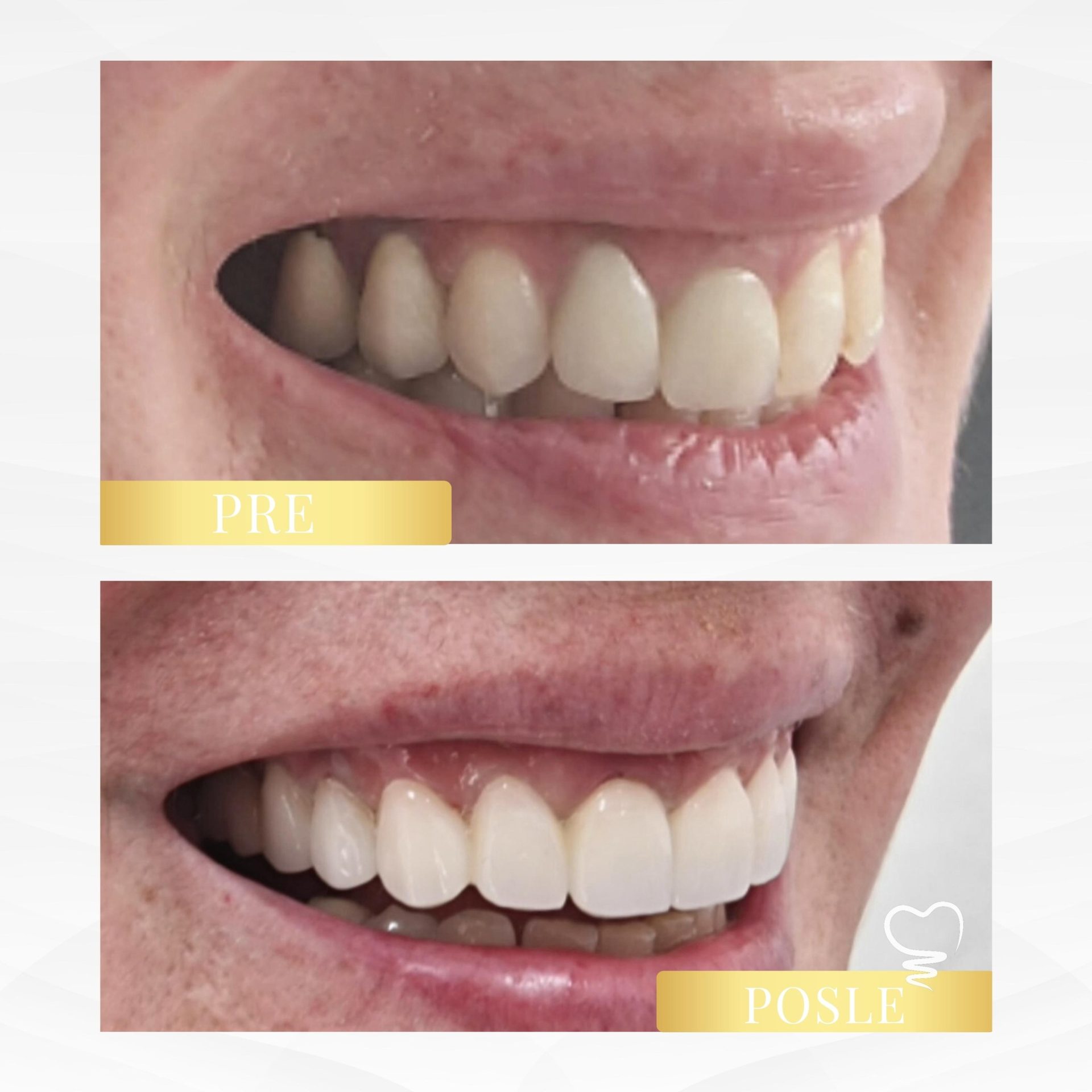 Dental & Aesthetic Center – Dr Miodrag Đokić Beograd (9)